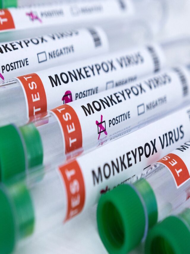 Monkeypox Virus (MPXV): Shocking News
