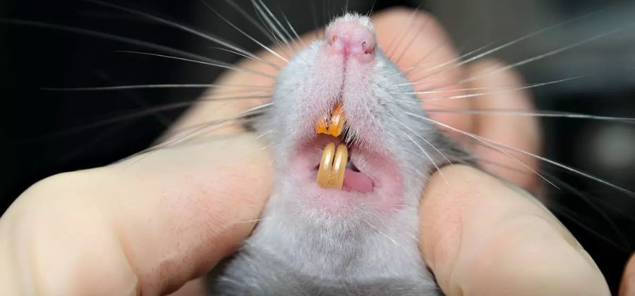 Rat bite fever
