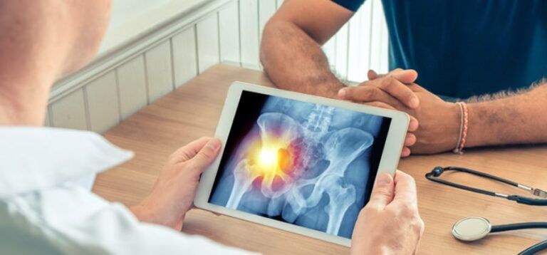 New study finds risk of hip fractures higher in vegetarians - High ...
